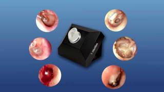 OtoSim™ Otoscopy Training amp Simulation  Intro [upl. by Lyon]