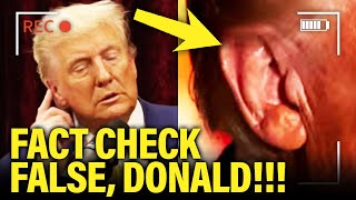 Trump SO CALLED EAR INJURY Claim BACKFIRES in His FACE [upl. by Vil]