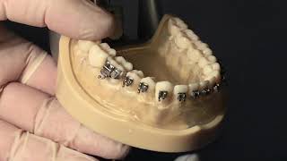 TKMOrthodontic procedures on a typodont Fitting of an orthodontic band [upl. by Oran]