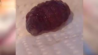 botfly parasite removal in cats rescue cats [upl. by Nanaek]