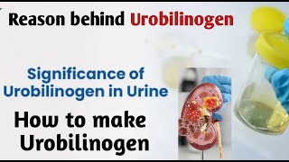 urobilinogen  urobilinogen in urine [upl. by Oscar108]