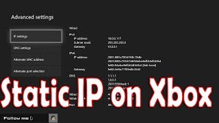 How to Setup Static IP on Xbox One [upl. by Anelec636]