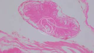 Schistosoma mansoni Sporocyst with Haematoxylin and Eosin HampE stain [upl. by Saerdna]