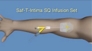 How to Insert SafTIntima™ SQ Infusion Set [upl. by Latin]