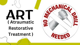 ARTatraumatic Restorative Treatment Public Health Dentistry [upl. by Adnav]