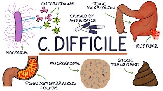 Understanding Clostridium Difficile Infection C Diff [upl. by Ennaeirb]