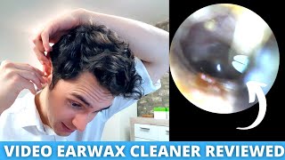 Ear Specialist Reviews Home Ear Wax Removal Camera Bebird Earokay Ear Cleaner [upl. by Araldo]