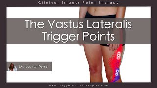 The Vastus Lateralis Trigger Points [upl. by Faunie]