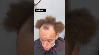 After before 🥲💯✅ hair transformation [upl. by Stuart]