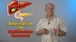 Cholecystostomy A Gentle Alternative to Gallbladder Removal [upl. by Pansir674]