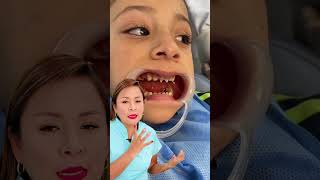 Una niña de 4 años recibiendo tratamiento de conducto y reconstruyendo sus dientecitos 👧🦷 [upl. by Ahsienek]