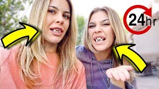 we took our teeth out for 24 hours  vlog amp story [upl. by Geis]