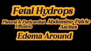 Fetal Hydrops  Ascites  Swelling  Pleural amp Pericardial Effusion  IUD 25 weeks on Ultrasound [upl. by Accebar]