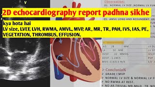 2D echocardiography ki report padhna sikhe [upl. by Melamed576]