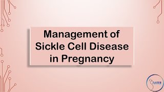 RCOG GUIDELINE Management of Sickle Cell Disease [upl. by Andromache]