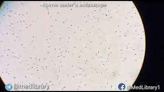 Espermatozoides observados con el microscopio optico [upl. by Sinclare]