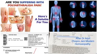 Polyarthralgia Multiple joint pain Cured ANA amp RA Positive to Negative by Dr Arpit Chopra Jain Homeo [upl. by Huff]