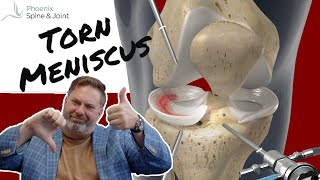 Over 55 with knee pain due to a torn meniscus should you have it scoped  A NEW STUDY [upl. by Terri]