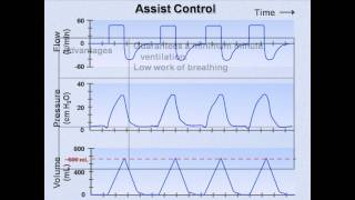 Ventilator Modes Mechanical Ventilation  Lecture 7 [upl. by Oech]