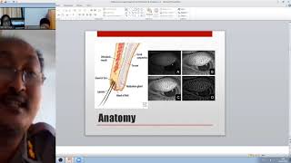 Management Hordeolum ampKhalazion [upl. by Lime700]