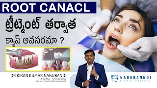 Is crowning necessary after a root canal   Dr Kiran Kumar Nagubandi  Nagubandi Dental Hospital [upl. by Amron]