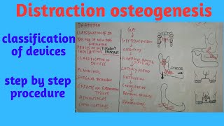 Distraction Osteogenesis partII [upl. by Krahmer]