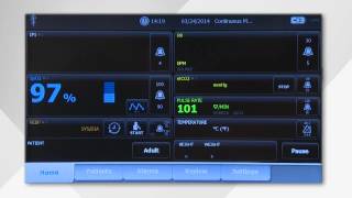 Welch Allyn Connex Vital Signs Monitor User Guide [upl. by Leonore]