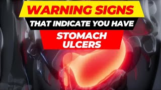 top 10 warning signs of stomach ulcers [upl. by Marlen]