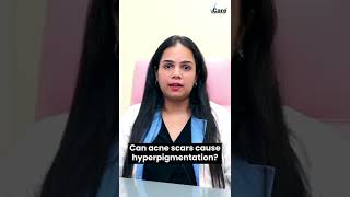 Acne Scars amp Hyperpigmentation  VCare Hair amp Skin Clinics  Skincare Tips [upl. by Preciosa96]