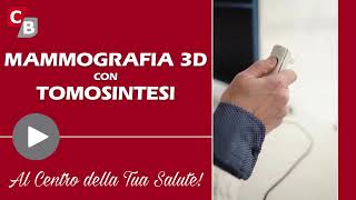 Mammografia 3D con tomosintesi [upl. by Hedvige399]