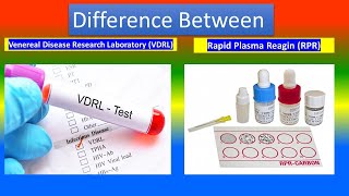 Venereal disease research laboratory VDRL test Vs Rapid plasma reagin RPR test [upl. by Giraud]