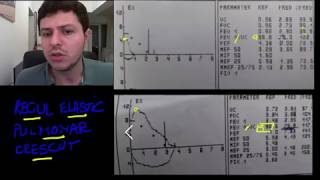 Spirometrie 8  recul elastic pulmonar crescut [upl. by Conley]