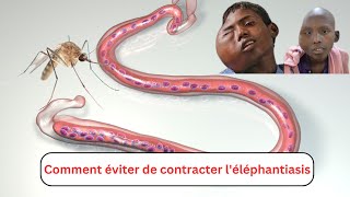 Comment éviter de contracter léléphantiasis [upl. by Oremo79]