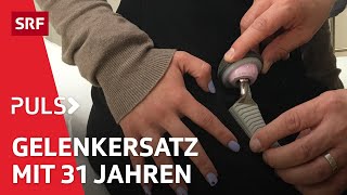 Arthrose Was hilft gegen den schmerzhaften Knorpelabbau in Knie und Hüfte  Puls  SRF Wissen [upl. by Einehpets]