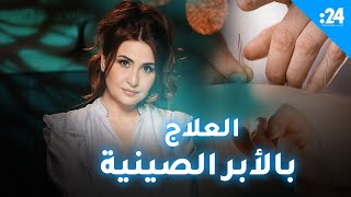 شيفرة علا الحلقة 9  العلاج بالأبر الصينية [upl. by Falk]