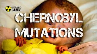 Chernobyl Mutations in Humans and Children of Chernobyl [upl. by Raine871]