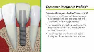 Straumann Bone Level Implants  Consistent Emergence Profiles [upl. by Obla]