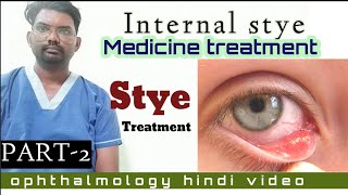 internal stye treatment  stye treatment  ophthalmologyhindivideo  styetreatment  optometry [upl. by Alberto]