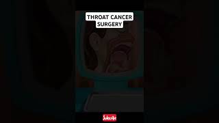 Throat Cancer Surgery cancer [upl. by Llerahc381]