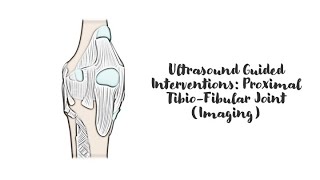 ultrasound Guided Interventions Proximal TibioFibular Joint Imaging [upl. by Kress879]