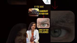 5 Causes Stye on Your Eyelid   How To Get Rid Of Stye From Eye  Vision Eye Centre [upl. by Nats]