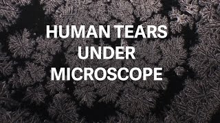 Micrograph photos reveal the unique beauty of tears [upl. by Kimitri344]