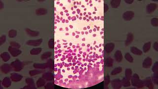 Microscopy  Peripheral blood smear preparation  Blood Smear  peripheral blood smear Hematology [upl. by Hinda]