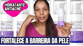 RESENHA GEL CREME HIDRATANTE DERMOTIVIM BENZAC OIL CONTROL MICROBIOMA EQUILIBRADO ACNE PROBIÓTICOS [upl. by Polash356]