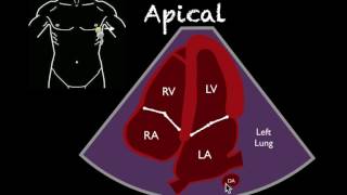 Bedside Ultrasound Basic Cardiac US [upl. by Mik541]