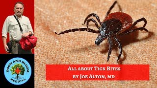 Tick Bites Prevention Protection Removal and Symptoms [upl. by Noreik379]