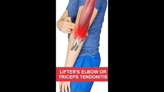 FIXING Lifters Elbow  Triceps Tendonitis 💪👌 3 EASY TIPS shorts [upl. by Haleehs]