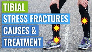 Tibial Stress Fractures  Treatment amp Healing Times [upl. by Ettennan]