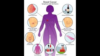 benign tumors of breast [upl. by Nnaik]