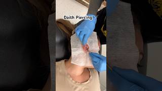 Daith piercing daithpiercing piercing bodypiercing safepiercing earpiercingearringspiercings [upl. by Omland501]